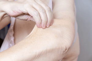 How does Weight Loss Impact Our Skin Health